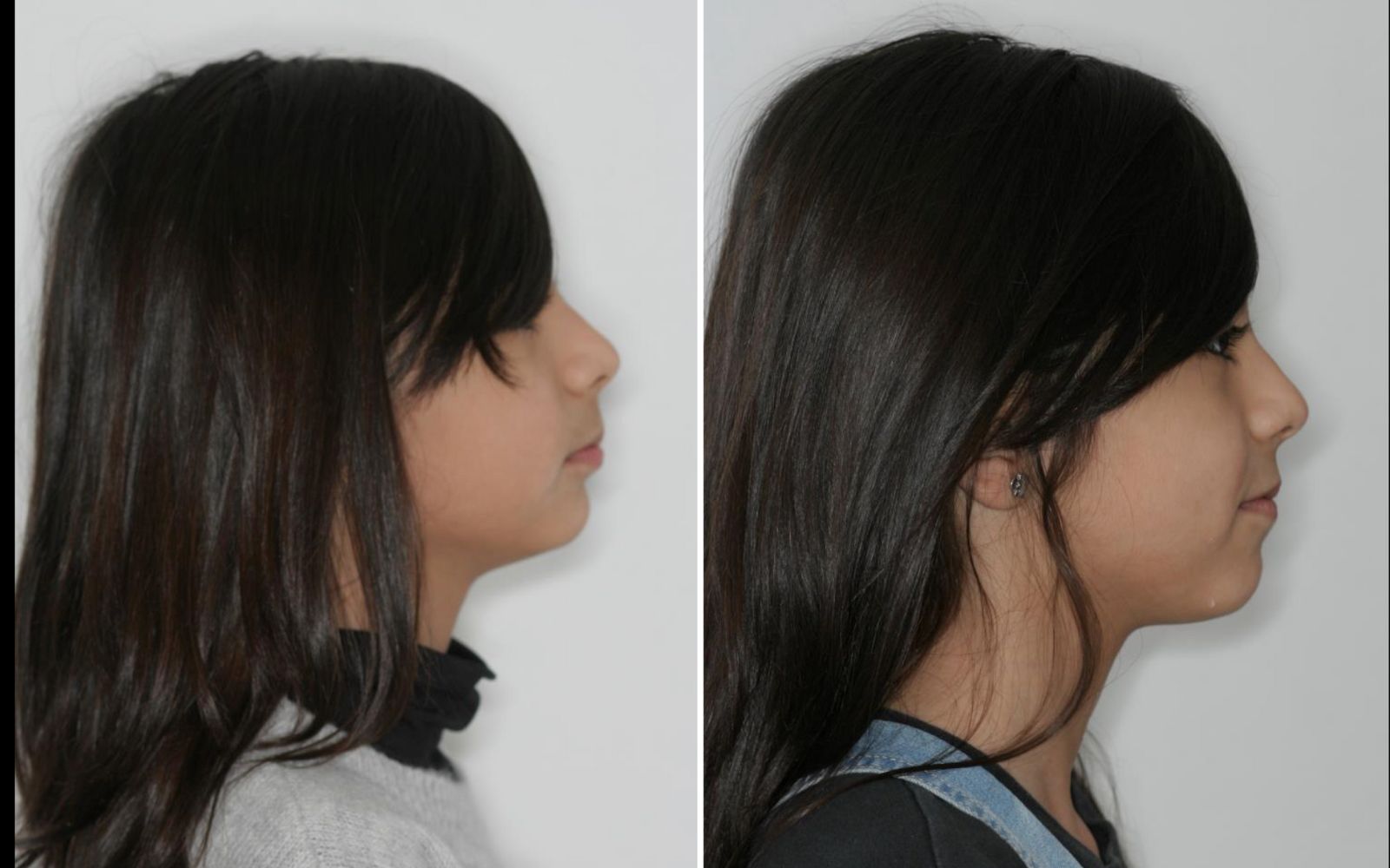 imagen craneomandibular1