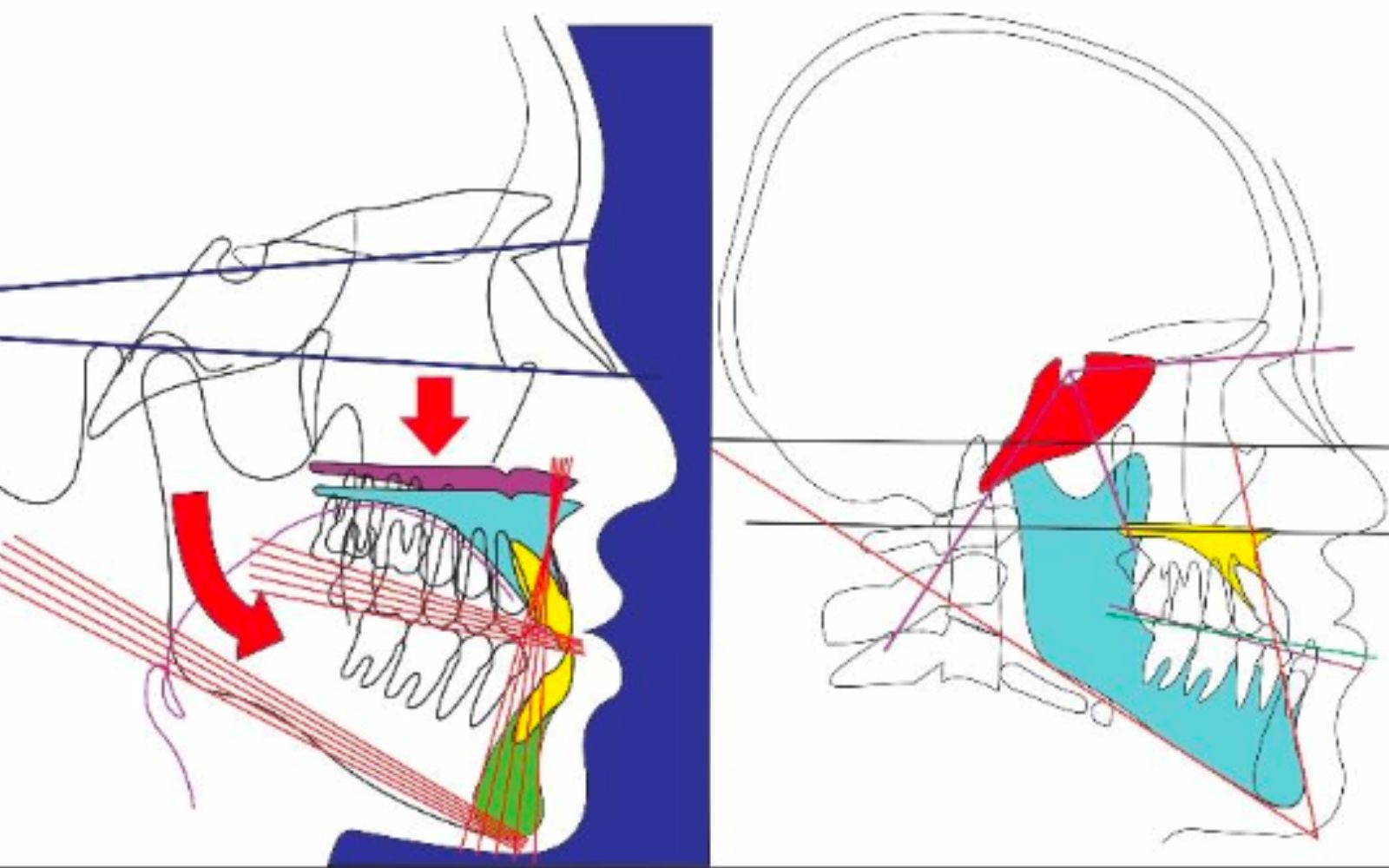 imagen craneomandibular2