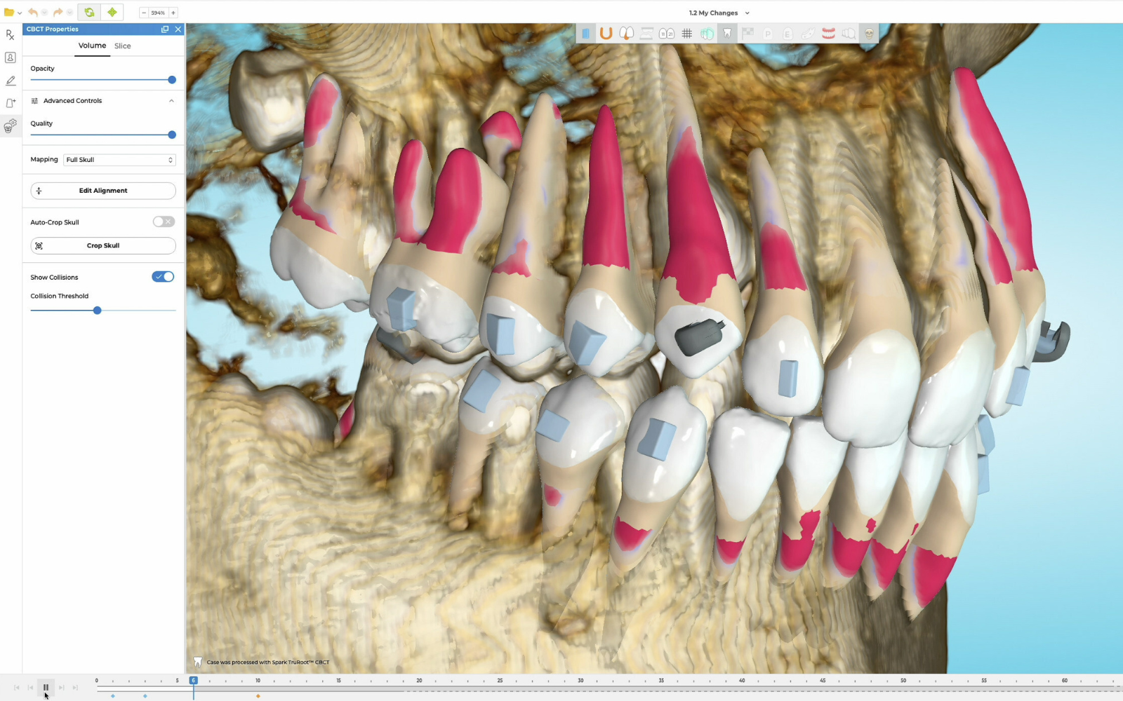 imagen laser1
