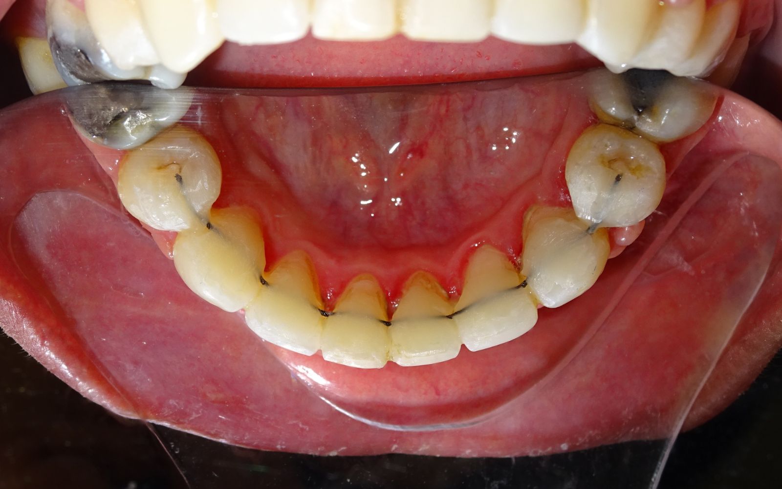 imagen laser3
