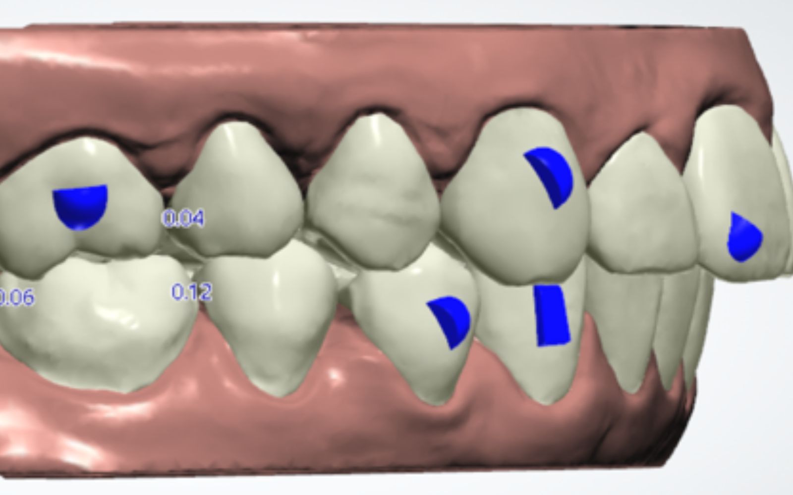 imagen laser3